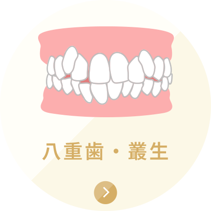 八重歯・叢生
