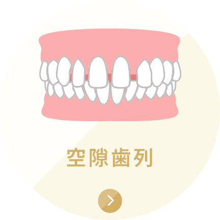 空隙歯列