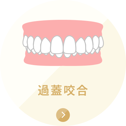 過蓋咬合