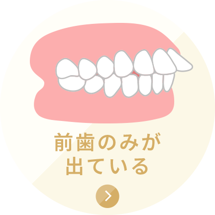 前歯のみが出ている